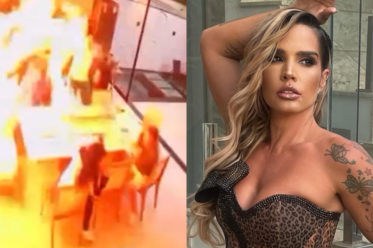 taty-zatto-fala-sobre-acidente-domestico-grave:-“labareda-de-fogo”