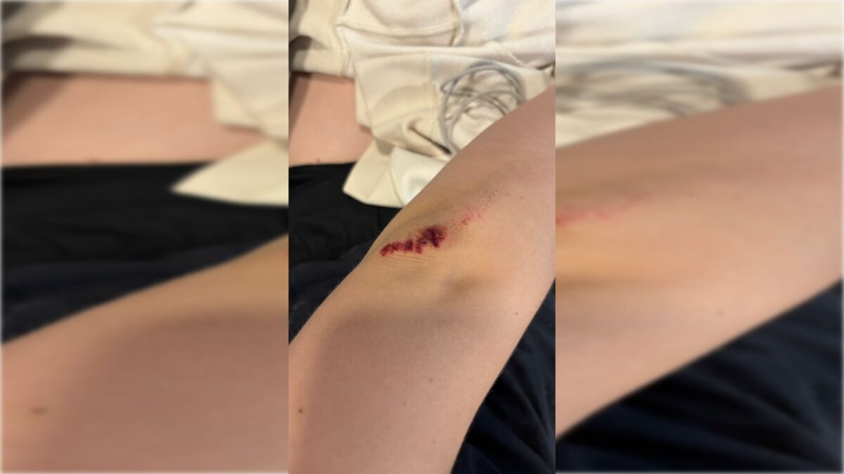 adolescente-se-joga-de-carro-de-app-no-df-por-medo-de-ser-estuprada