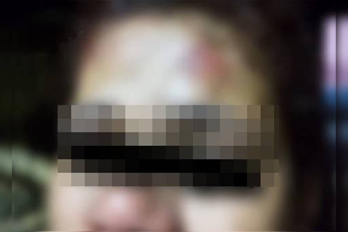 fotos:-homem-esfaqueia-mulher-e-fere-filho-de-3-anos-com-facada-na-mao