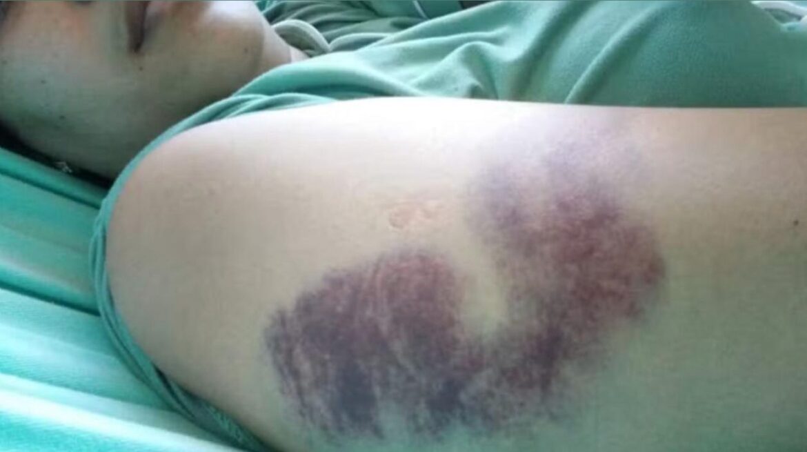 motorista-de-aplicativo-espanca-fisioterapeuta-apos-discussao