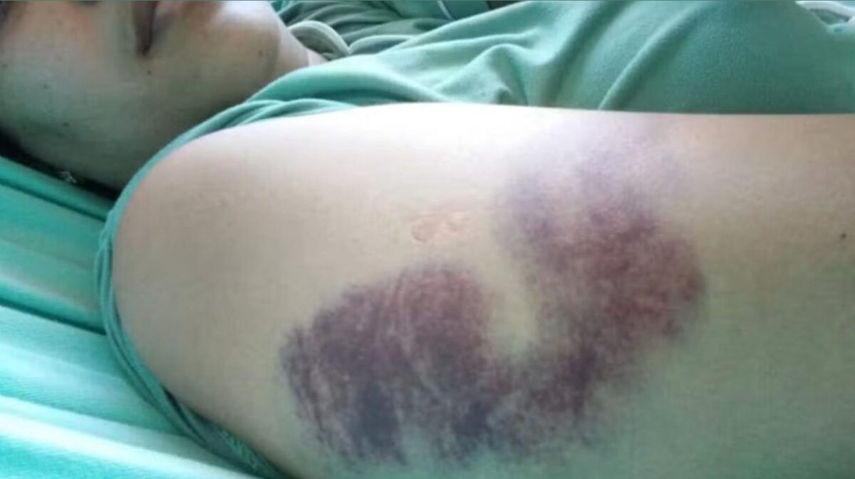 motorista-de-aplicativo-espanca-fisioterapeuta-apos-discussao