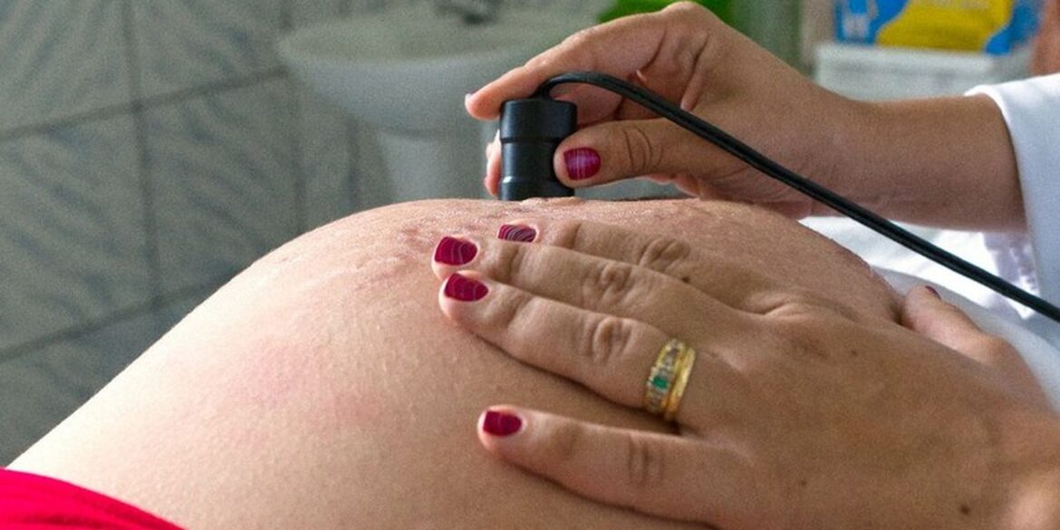 assistencia-ao-parto-avanca-no-brasil,-mas-pre-natal-ainda-preocupa