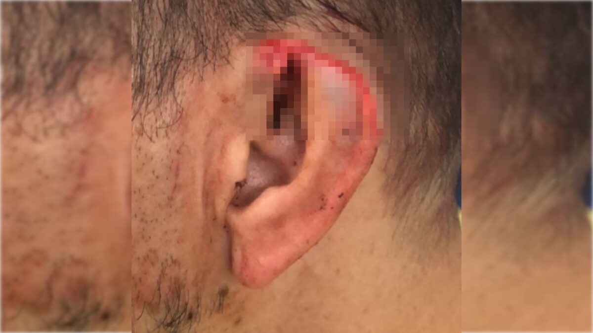 jovem-quis-invadir-hospital-apos-arrancar-parte-de-orelha-de-namorado