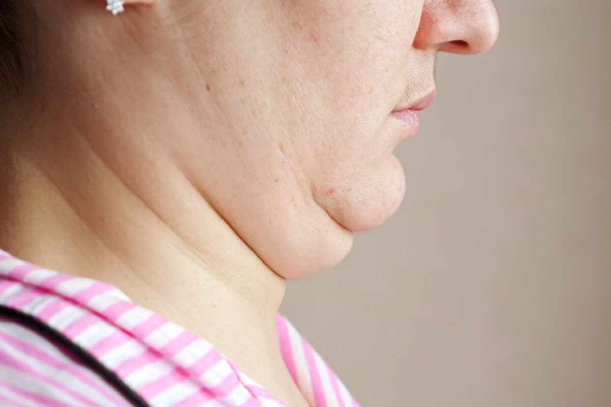 como-reduzir-a-papada?-experts-dao-dicas-de-treino-e-alimentacao