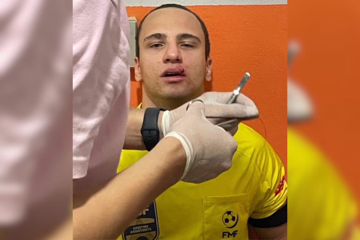 arbitro-assistente-e-agredido-em-partida-de-futebol-em-mato-grosso