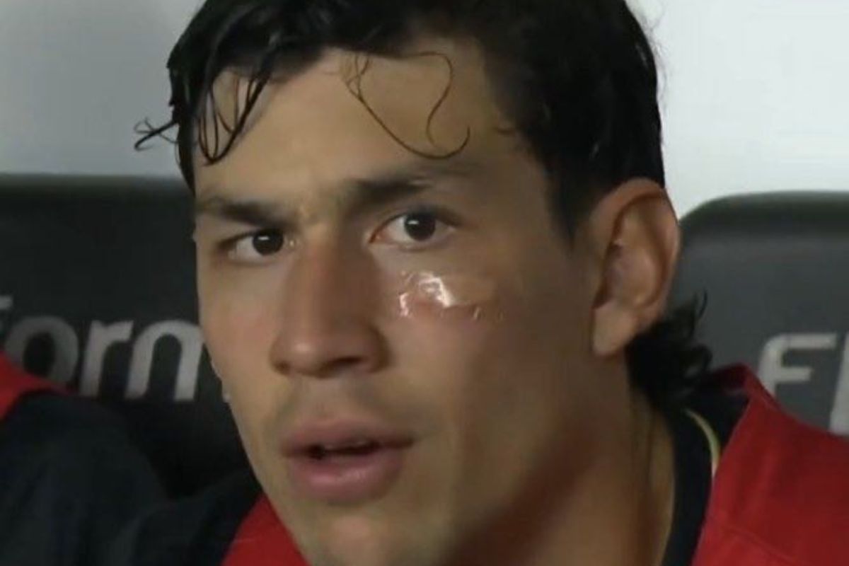 ferraresi-se-choca-com-companheiro-de-time-e-leva-dois-pontos-no-rosto