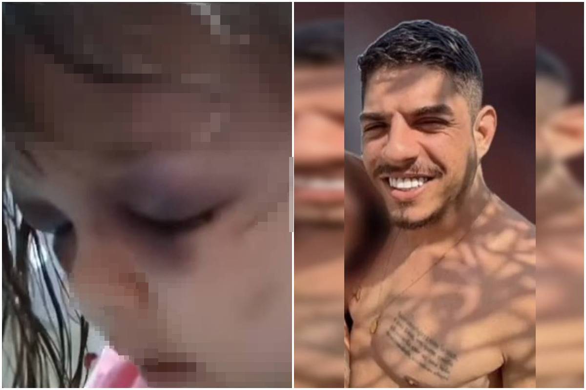 menina-de-3-anos-e-brutalmente-espancada;-padrasto-esta-foragido.-veja