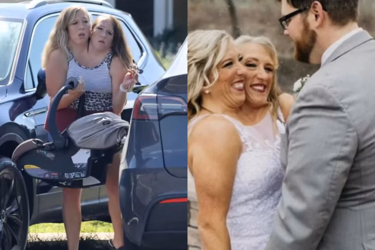 Gêmeas siamesas Abby e Brittany aparecem com bebê e levantam rumores de maternidade