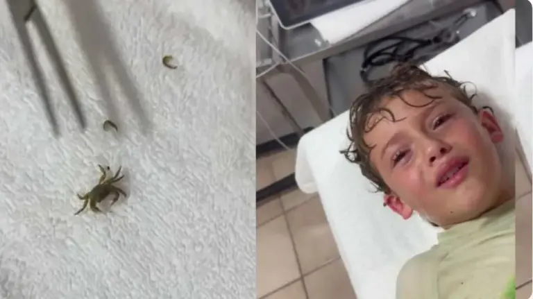 VÍDEO: menino tem caranguejo vivo retirado do ouvido e vídeo viraliza