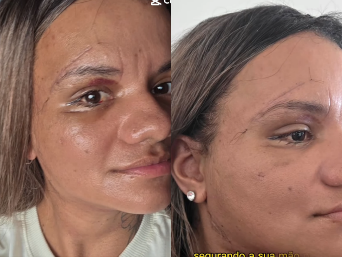 familia-se-manifesta-sobre-suposto-abuso-contra-homem-preso-por-agredir-namorada