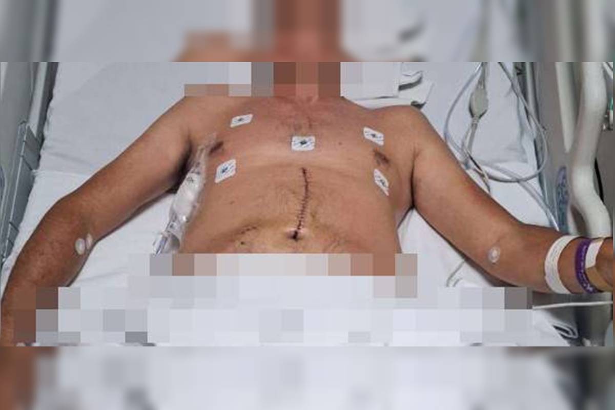 fab-x-pm:-sargento-que-esfaqueou-major-em-briga-de-transito-e-solto