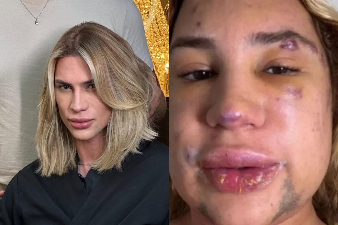 influencer-que-morreu-apos-procedimento-havia-denunciado-medico