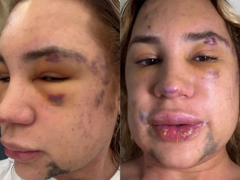 influenciador-que-morreu-ja-tinha-processado-suposto-medico-por-6-crimes