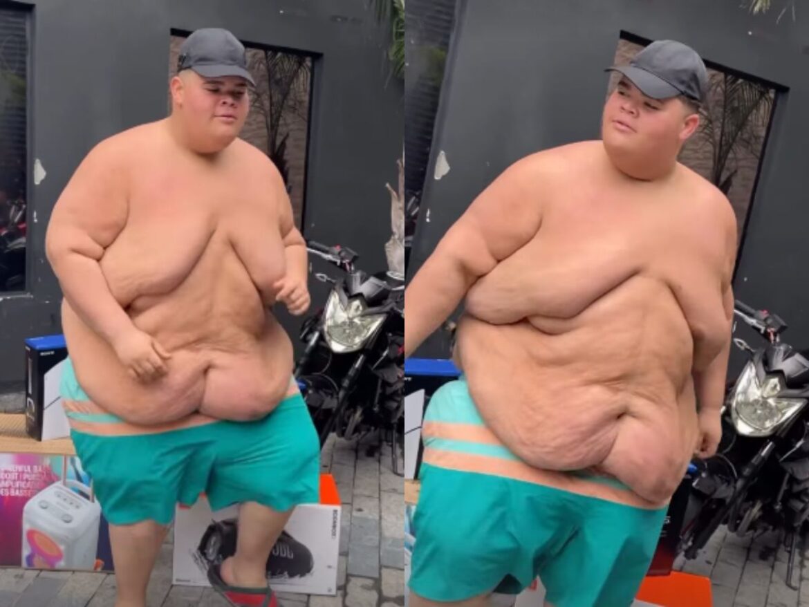 influenciador-gordao-da-xj-exibe-nova-forma-apos-perder-mais-de-115-kg