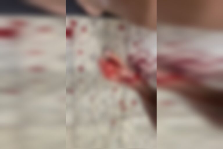 filho,-de-21-anos,-confessa-assassinato-da-propria-mae.-motivo-choca