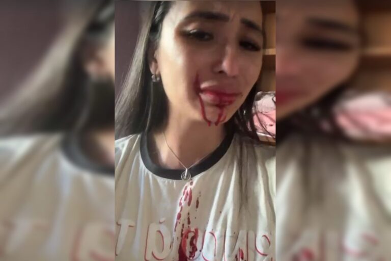 Vídeo: em surto, mãe joga facão no rosto de ex-dançarina do Faustão