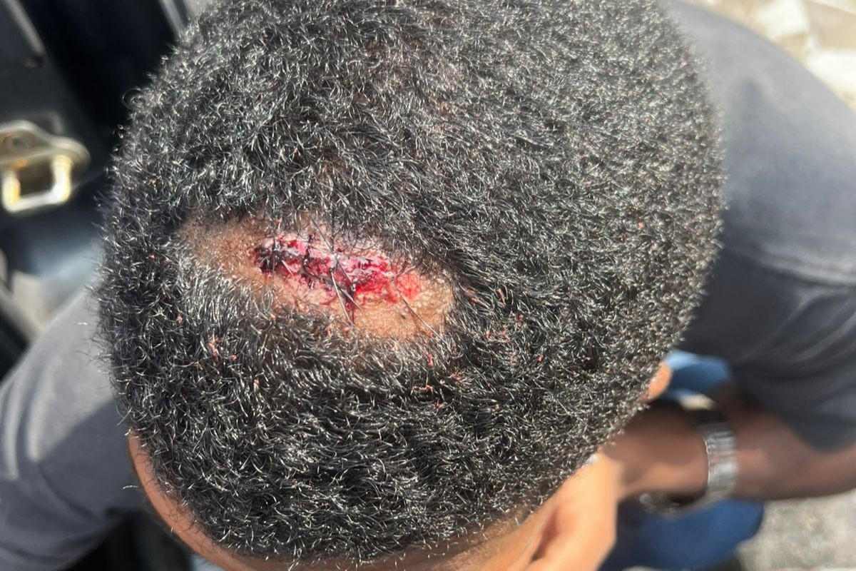 pm-atira-em-homem-sentado-na-calcada-durante-apreensao-de-motos.-veja