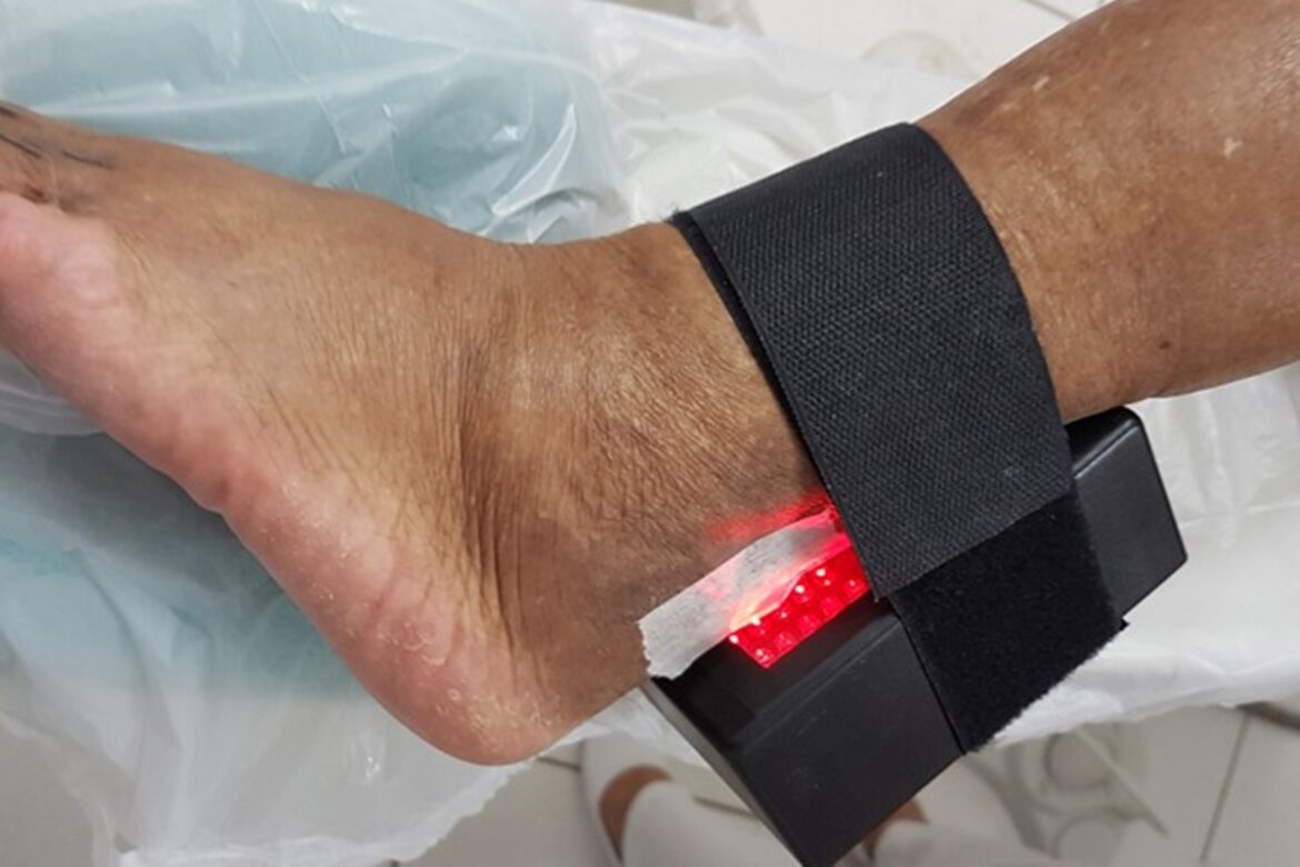 dispositivo-criado-por-pesquisadora-da-unb-ajuda-a-evitar-amputacoes