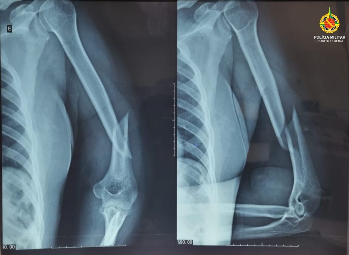 carroceiro-e-preso-apos-espancar-e-torturar-mulher-durante-6-horas-no-df