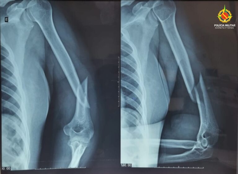 Carroceiro é preso após espancar e torturar mulher durante 6 horas no DF