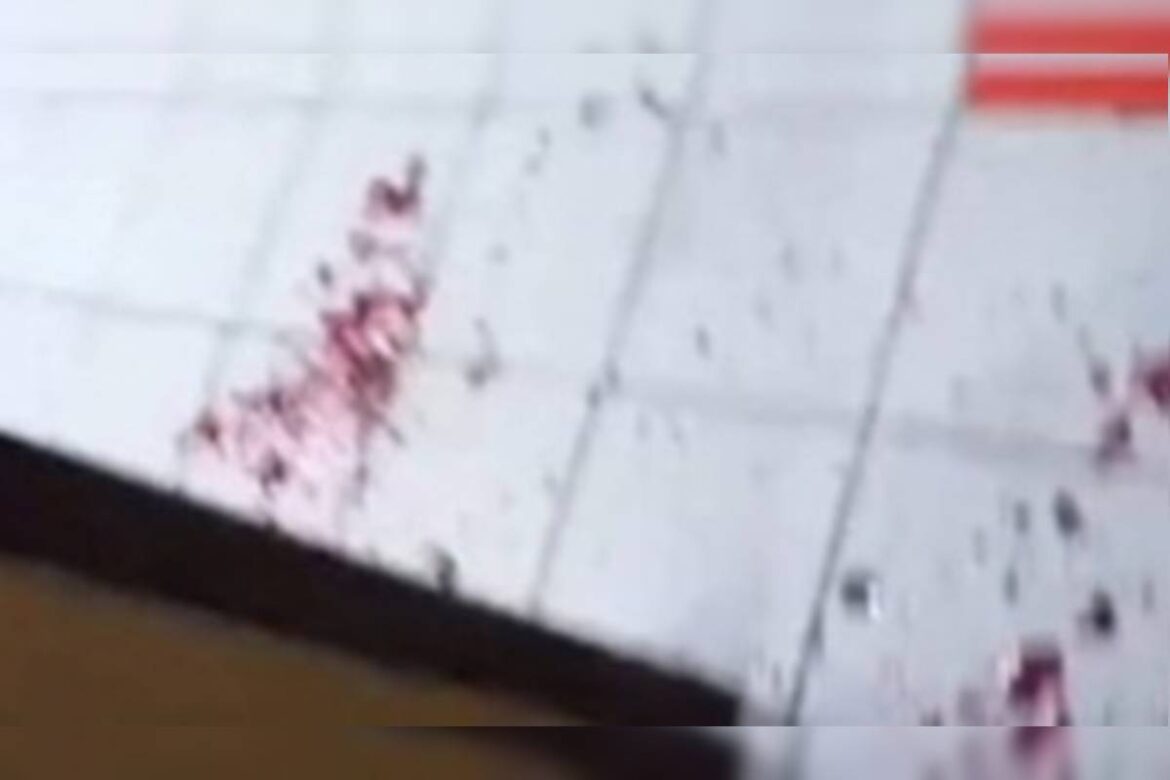 idosa-e-atacada-por-pit-bull-solto-na-rua-e-salva-por-jovens-em-goias