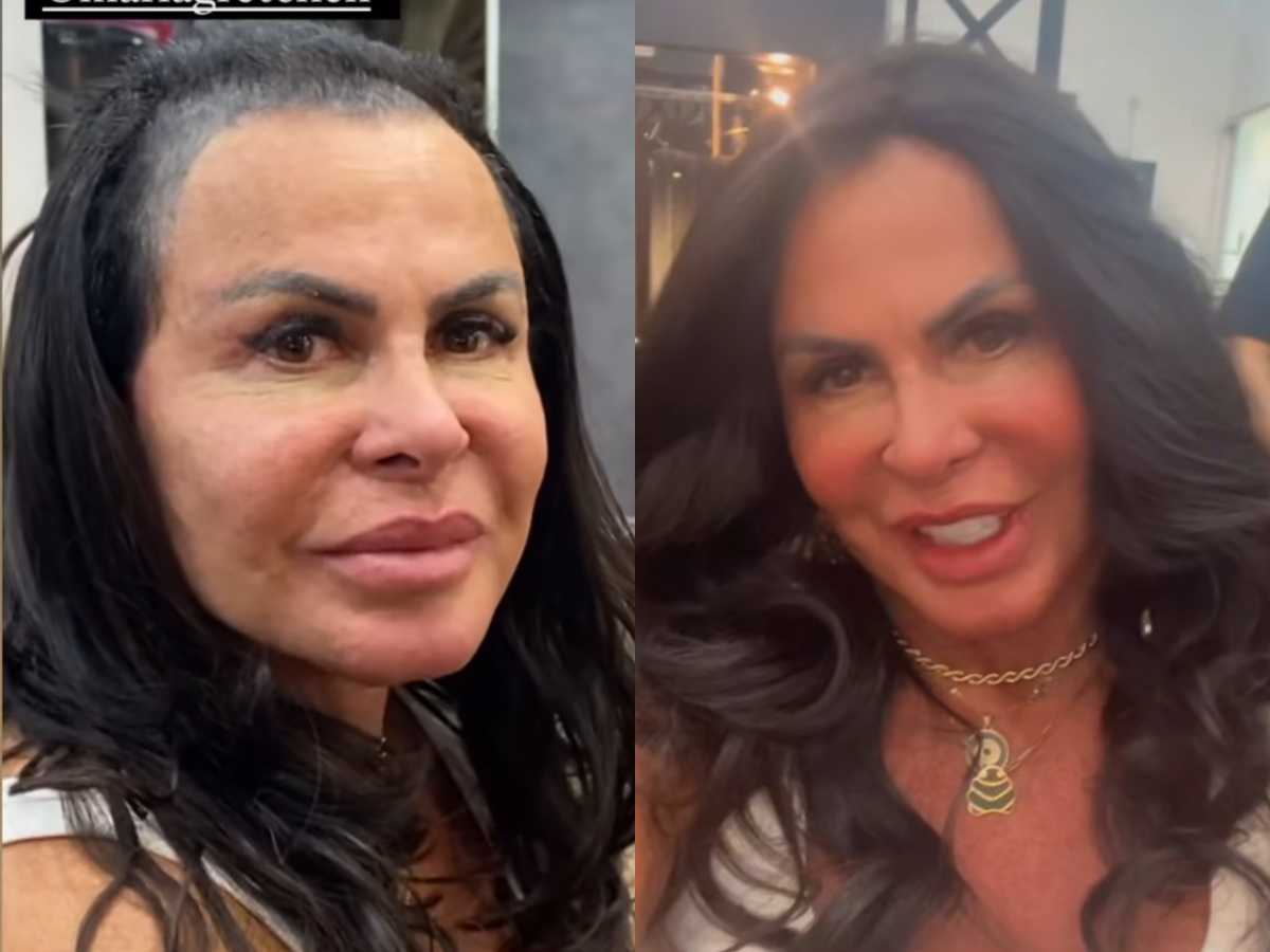 “Não tenho mais cabelo”: Gretchen desabafa sobre queda capilar