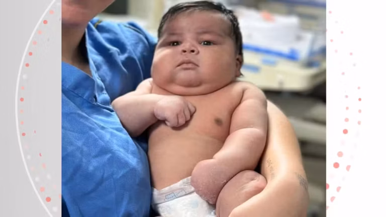 Bebê gigante nasce de parto normal pesando 6,5 kg; mãe sofreu hemorragia e pegou 55 pontos