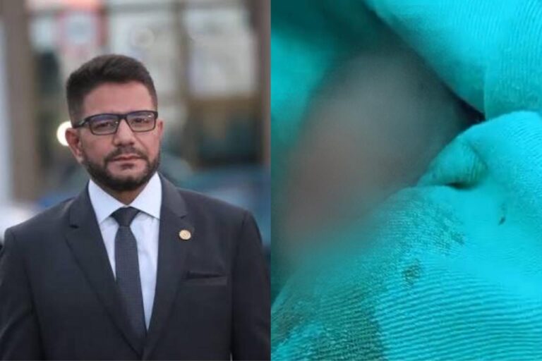 Gladson afasta equipe médica que verificou óbito de bebê na maternidade de Rio Branco