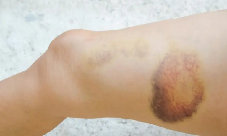 No Acre, menino de 9 anos é espancado pelo próprio pai e levado ao Pronto-Socorro; veja mais