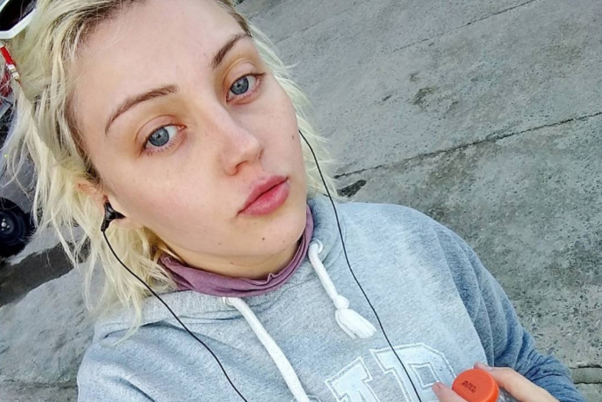 a-morte-da-“barbie-humana”:-veja-fotos-da-mulher-antes-das-plasticas