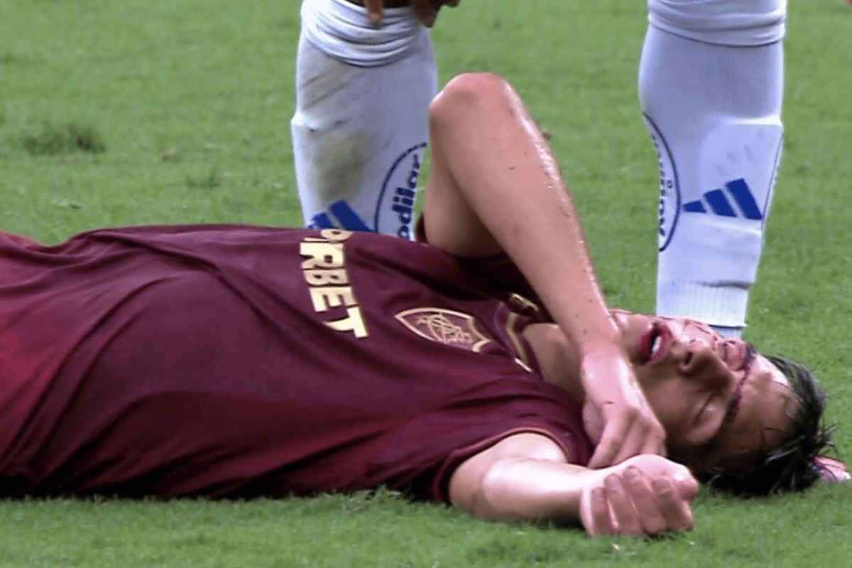 video:-jogador-do-fluminense-cai-ensanguentado-apos-cotovelada