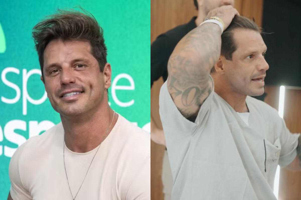 fotos:-fernando-fernandes-passa-por-transplante-capilar