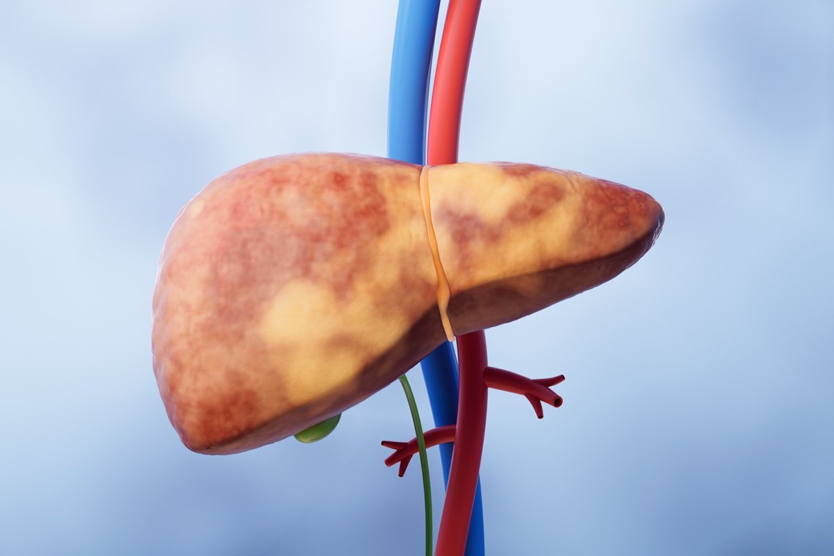 o-cha-campeao-para-a-saude-do-figado,-revelado-por-nutricionista