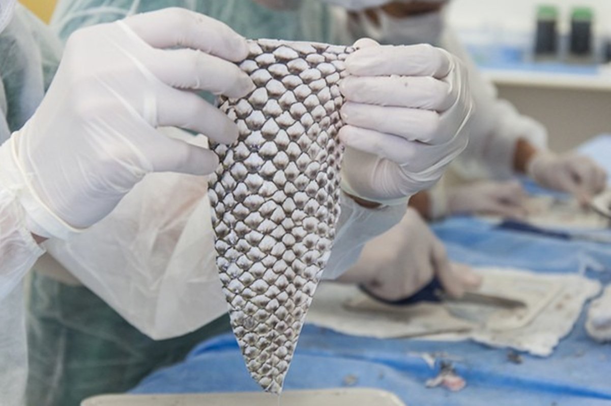 universidade-abre-mao-de-patente-de-curativo-feito-com-pele-de-tilapia