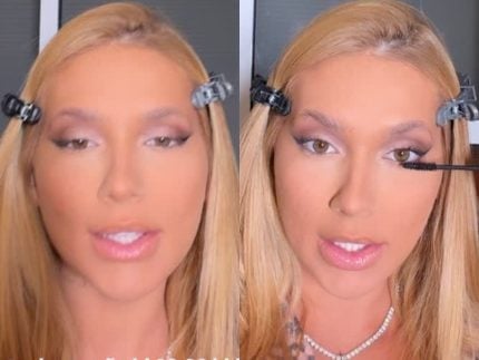 virginia-fonseca-conta-que-hormonios-para-engravidar-causaram-espinhas-e-manchas-no-rosto