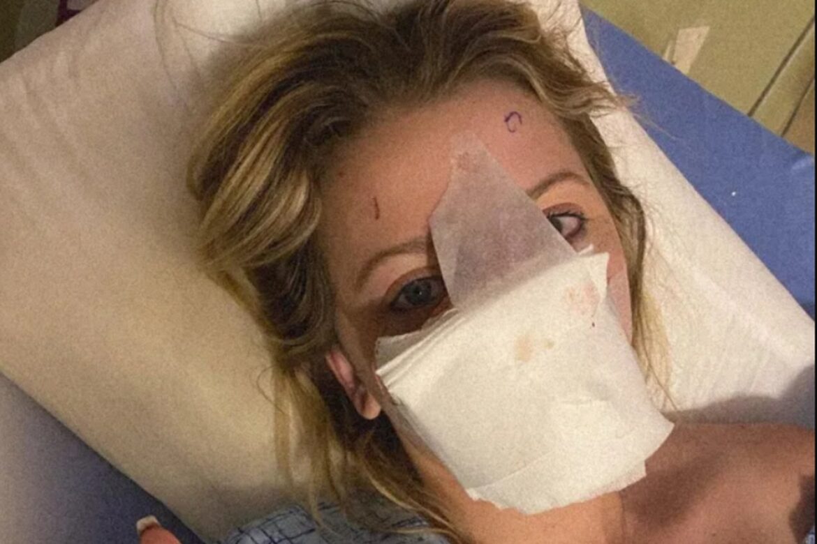 mulher-que-teve-nariz-arrancado-por-cao-mostra-o-rosto-apos-16-cirurgias