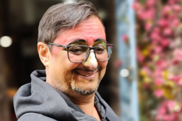 Famosos lamentam morte trágica de ator Tony Germano