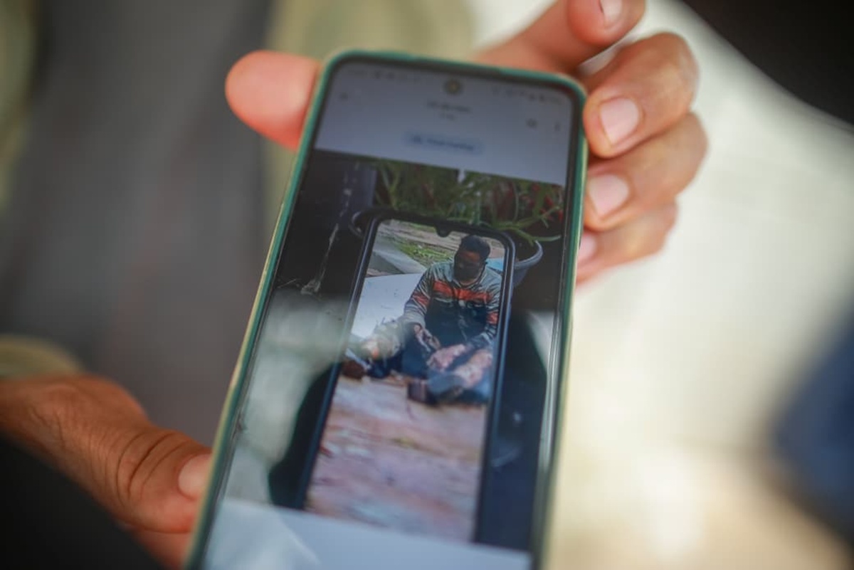 explosao-em-ministerio:-estado-de-homem-que-teve-60%-do-corpo-queimado-e-gravissimo