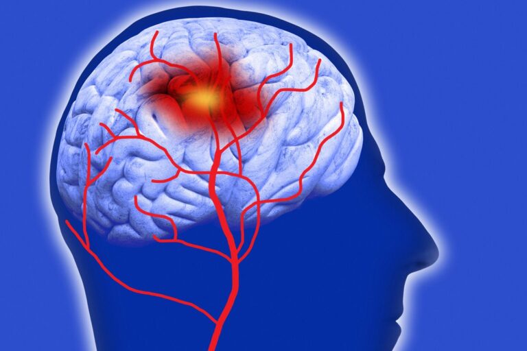alimentos-que-ajudam-a-controlar-a-pressao-arterial-e-a-prevenir-o-avc