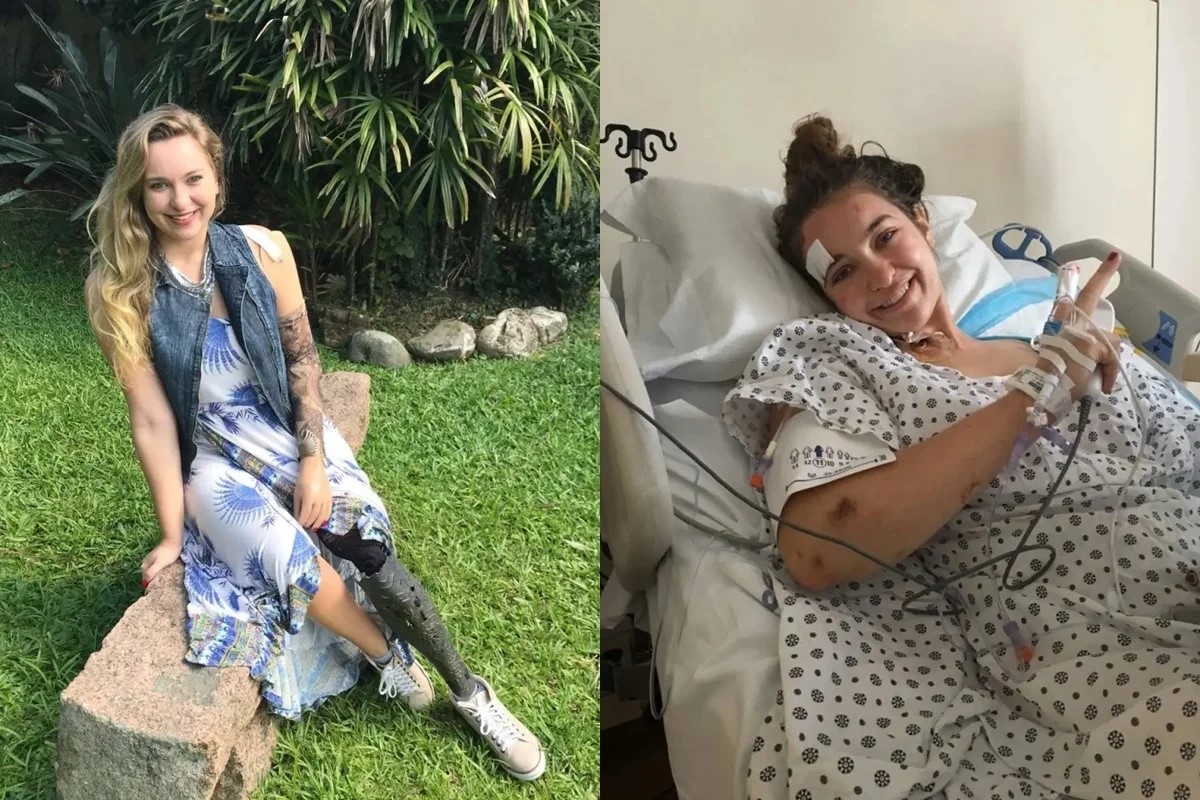 quem-e-a-brasileira-indenizada-em-us$-81,7-milhoes-apos-ser-atropelada