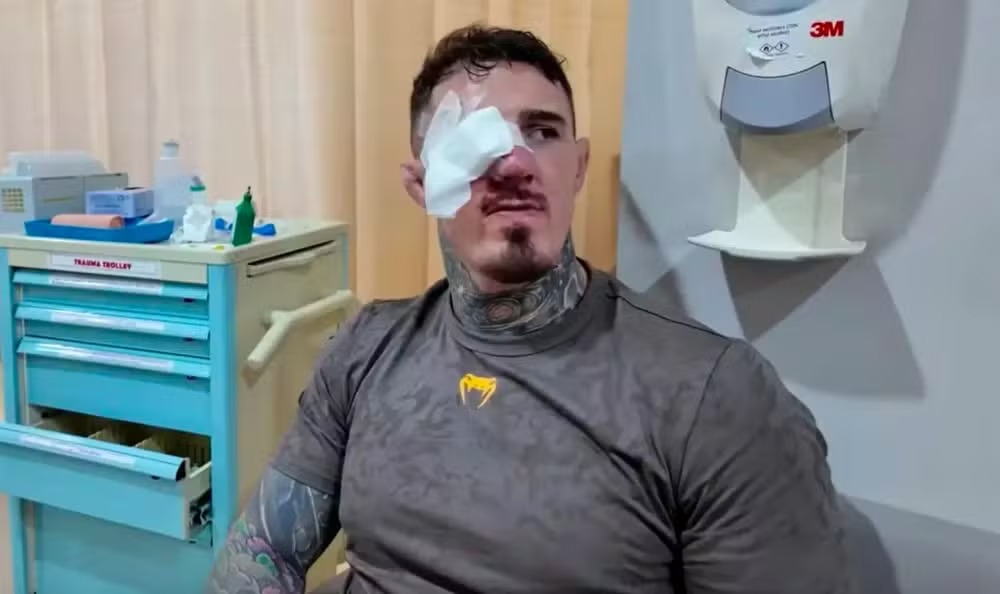 Astro do UFC é diagnóstico com doença rara após dedada de adversário