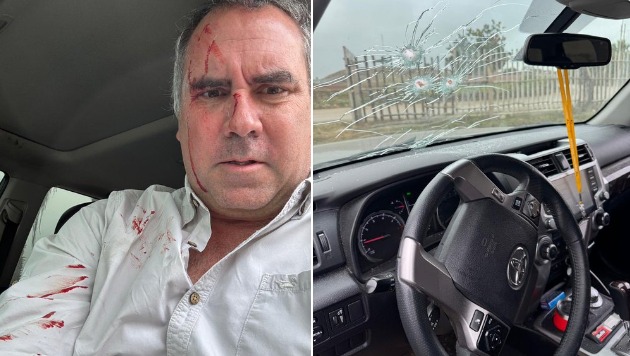 candidato-a-presidencia-do-peru-sofre-atentado-durante-campanha