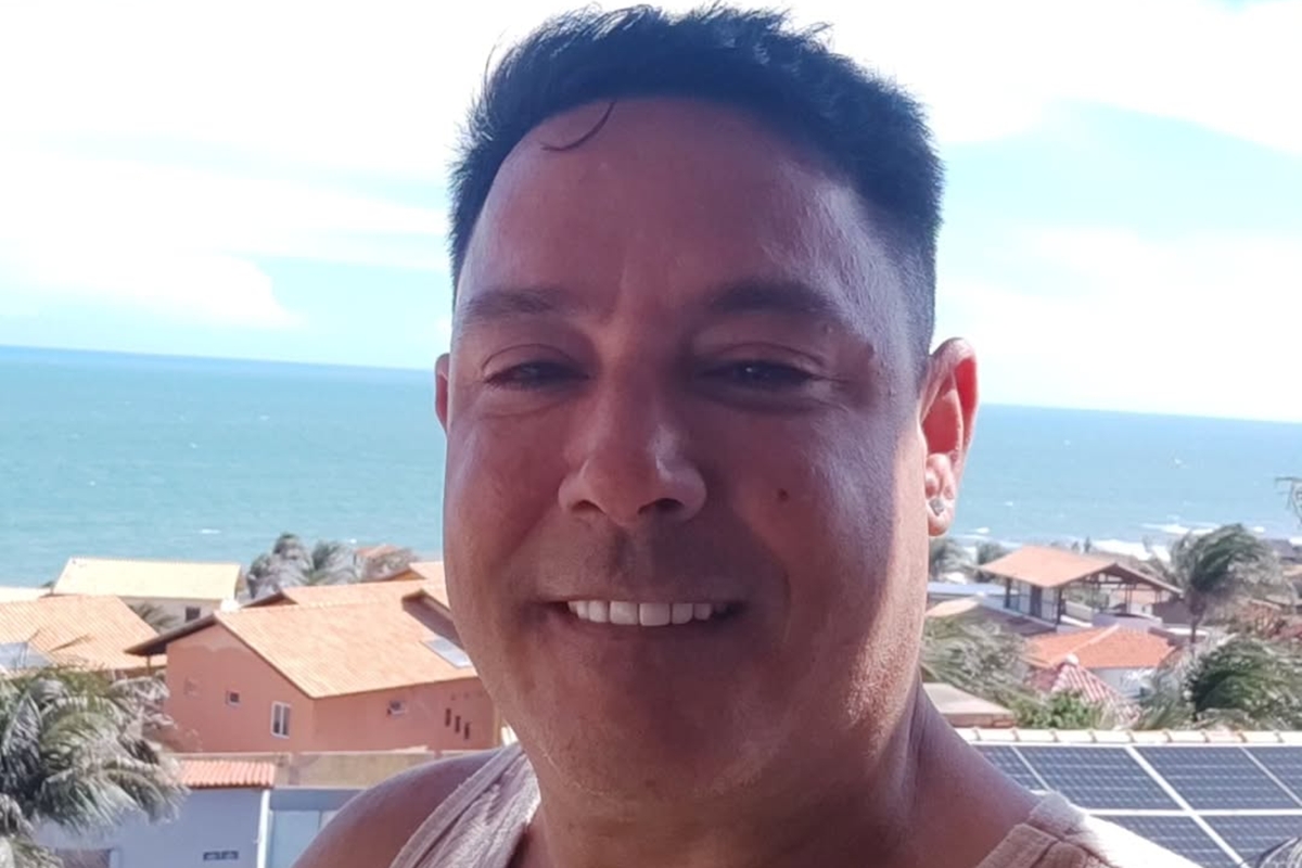 vava-surge-irreconhecivel-apos-harmonizacao-e-transplante-capilar