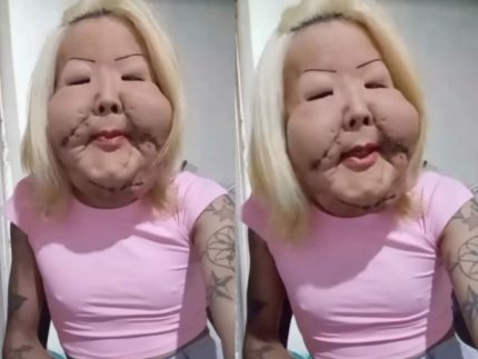 apos-cirurgia-reconstrutiva,-juju-do-pix-revela-novo-rosto-e-agradece-apoio