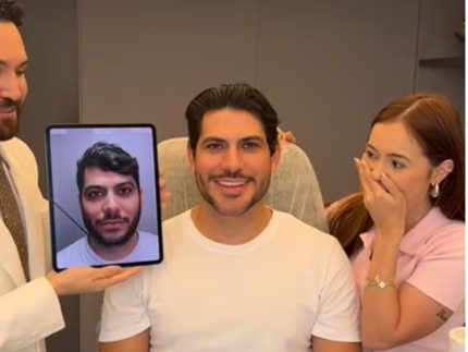 mirela-janis-mostra-o-antes-e-o-depois-da-harmonizacao-facial-de-yugnir