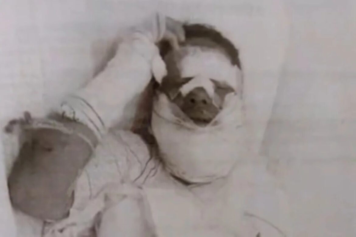 homem-e-preso-apos-jogar-alcool-e-atear-fogo-no-rosto-da-companheira