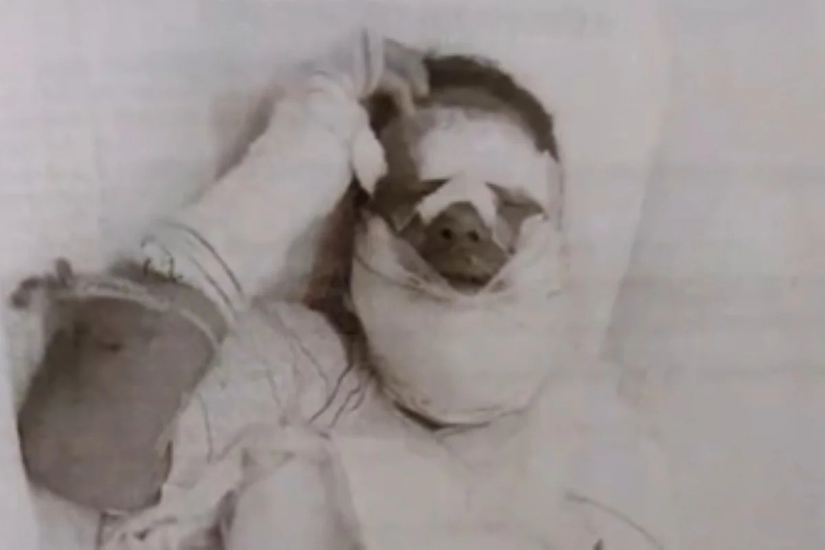 homem-e-preso-apos-jogar-alcool-e-atear-fogo-no-rosto-da-companheira