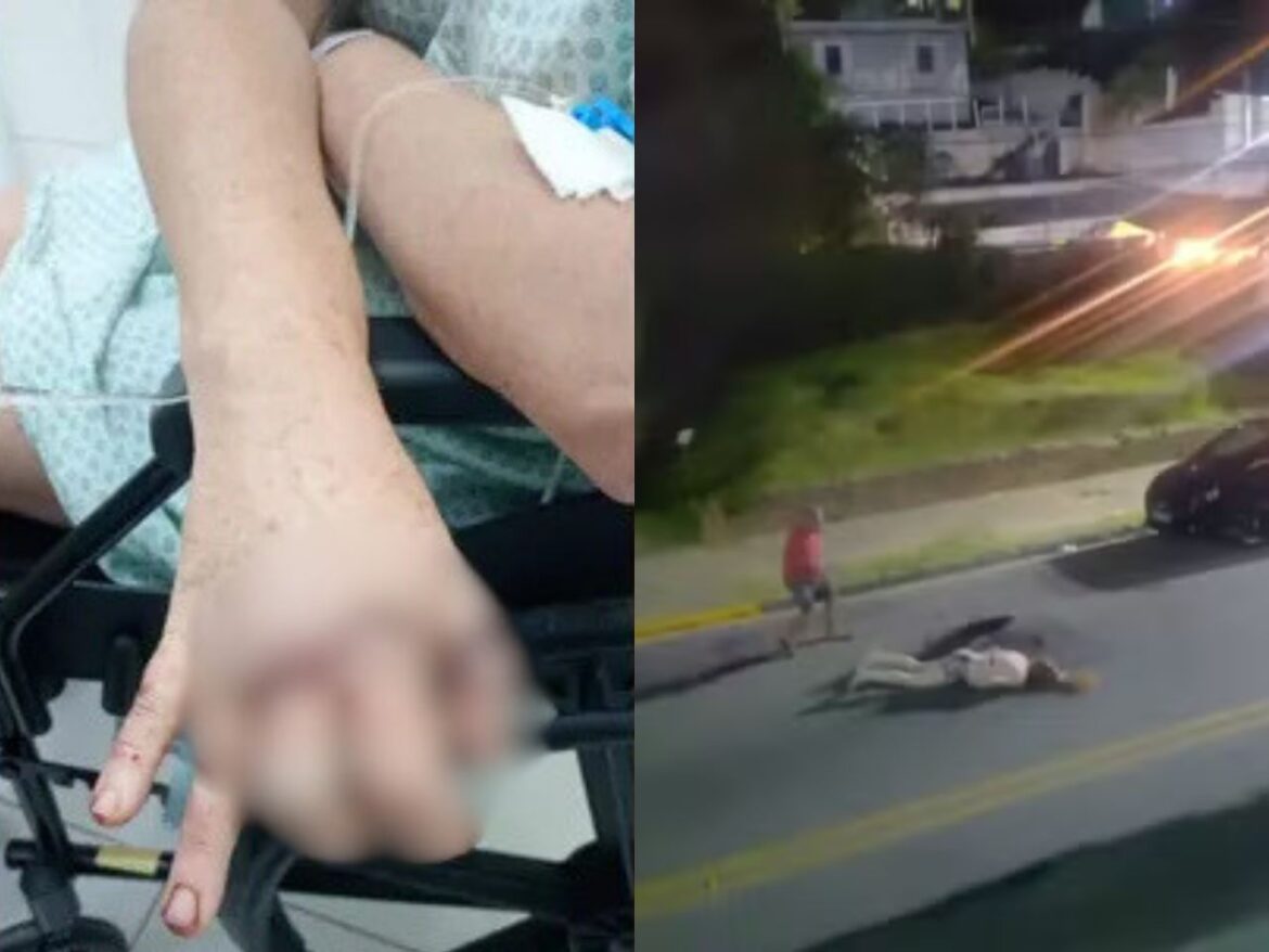 homem-que-agrediu-mulher-com-tacho-volta-ao-local-do-crime-e-e-espancado