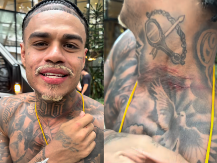 mc-cabelinho-mostra-pescoco-machucado-apos-sofrer-tentativa-de-assalto-em-salvador