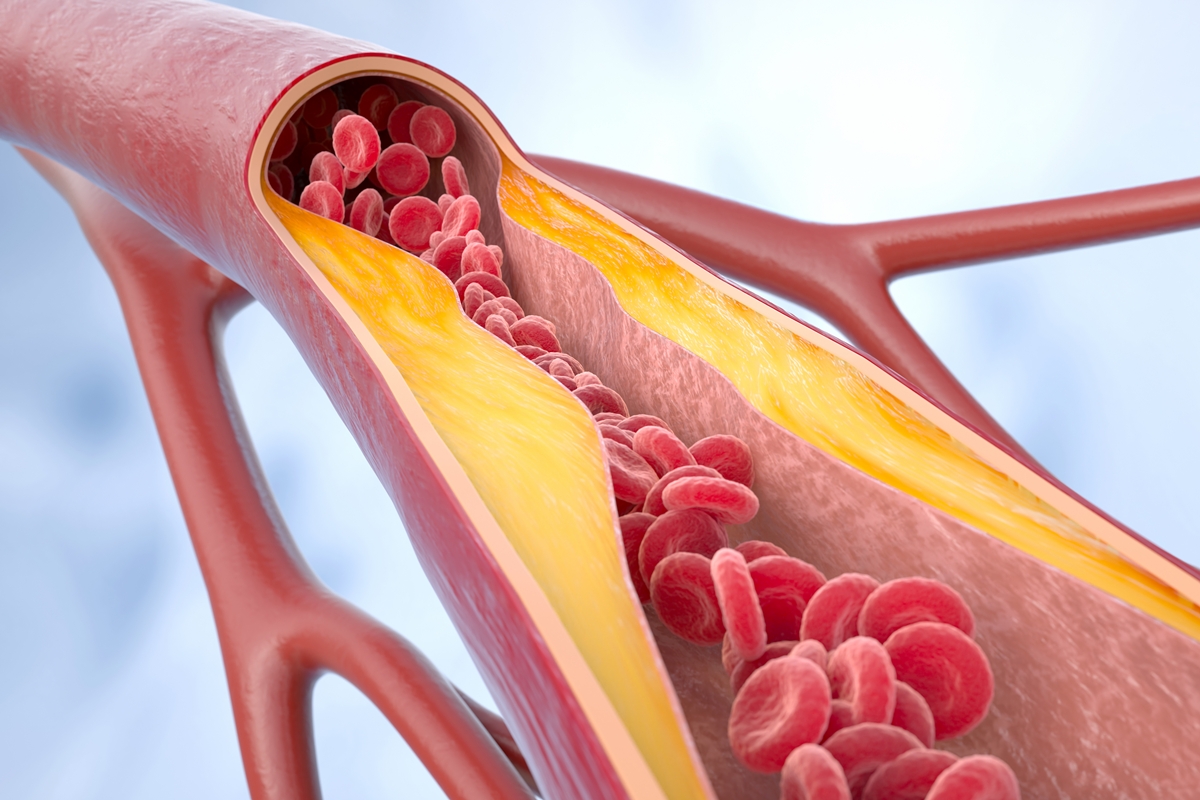 medico-vascular-lista-os-melhores-vegetais-para-a-saude-das-arterias